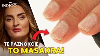 Te PAZNOKCIE to MASAKRA  naprawa zerwanego paznokcia krok po kroku  Indigo Nails [upl. by Willms]