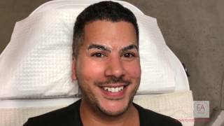 Mens Eyebrow Microblading Melbourne Victoria  Eye Art Studio [upl. by Notsnhoj]