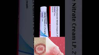 Onabet Cream  Sertaconazole Nitrate Cream Uses and side effects in Hindi [upl. by Eneluqcaj]