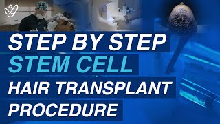 Transform Your Hair StepbyStep Stem Cell Hair Transplant [upl. by Samoht]