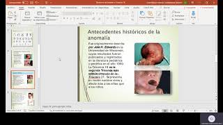 Sindrome de Edwards o Trisomia 18 [upl. by Dang]