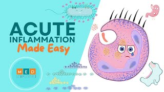 Acute Inflammation Made Easy [upl. by Jaime]