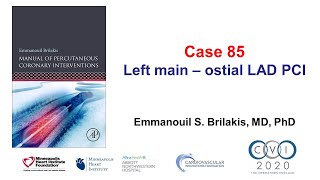 Case 85 PCI Manual  Ostial left mainLAD bifurcation stenting [upl. by Mauve154]