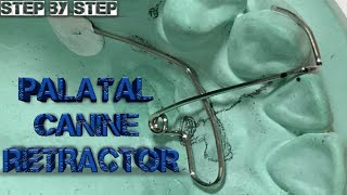 palatalcanineretractor palatalcanineretractorfabrication palatal canine retractorstep by step [upl. by Amlev]