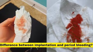 implantation bleeding vs periodimplantation bleeding or periodimplantation vs period [upl. by Elegna]