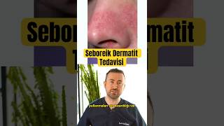 Seboreik Dermatit Tedavisi [upl. by Alenas]