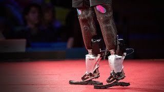 New bionics let us run climb and dance  Hugh Herr  TED [upl. by Roselba]