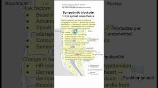 Sympathetic blockade from spinal anesthesia [upl. by Lynnelle]