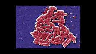 BACTERIA SHIGELLA  PODCAST 3B [upl. by Bathesda]