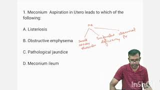 Neonatology MCQTopic 1 MECONIUM ASPIRATION SYNDROME mcq newborn education neet [upl. by Arndt]