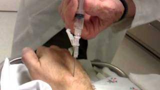 Ganglion Cyst aspiration  removal D [upl. by Shugart]