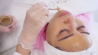 Experience flawless skin with Dermamelan at Lucia Clinic [upl. by Chance]