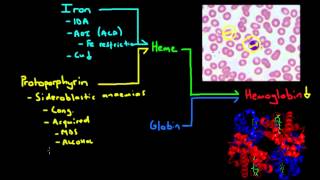 Microcytic Anemia  The Major Causes [upl. by Hoehne104]