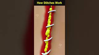 How wound stitches really work shorts facts  Creativelearning3d [upl. by Yla817]