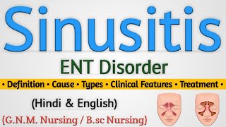 Sinusitis Sinusitis In Hindi Nursing Lecture [upl. by Renata946]