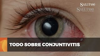 ✅ Todo sobre la conjuntivitis  Salud180 🌿 [upl. by Leahciam]