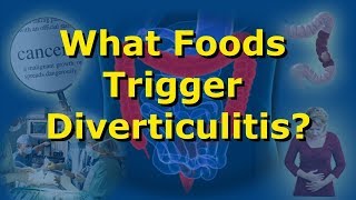 What Foods Trigger Diverticulitis [upl. by Eno]