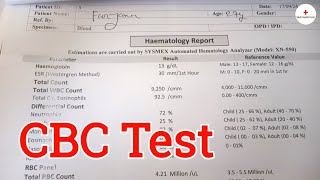 CBC Test Report  CBC Test Review  Investigation  Health tips bangla  Medi Health Point [upl. by Euqinad]