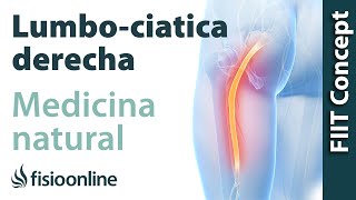 Ciáticalumbociática derecha  Visión desde la fisioterapia y la medicina natural [upl. by Sillert820]