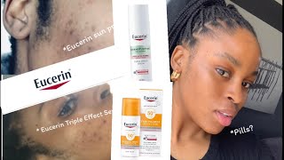 Eucerin Serum Review Clearing my skin with eucerin acnetreatment skincareSA YouTuber [upl. by Akcirret]