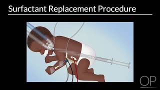 Surfactant Replacement in Neonates by B Walsh  OPENPediatrics [upl. by Hurd]