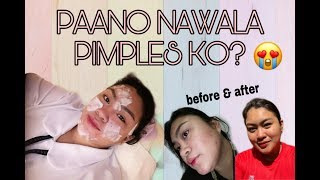 VLOG 9 PIMPLEACNE SOLUTION DERMCARE ANTIACNE FACIAL PAANO NAWALA PIMPLES KO  JecaTherese🇵🇭 [upl. by Yanel182]