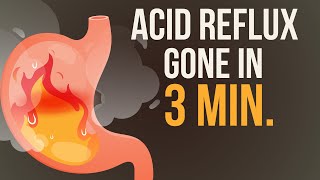 Reduce your Acid Reflux  Heartburn in just 3 Minutes 🔥 [upl. by Leaper]