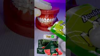 🍬🍑Teeth no or yes❓❓🤔🤔teeth health trending shorts dentist orthodontist [upl. by Ardnuhsor]