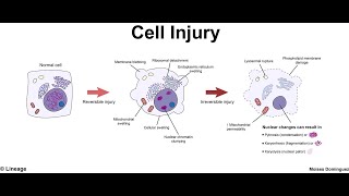 pathogenesis of cell injury [upl. by Downing]