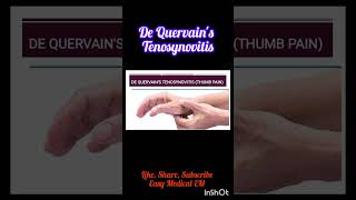 What is De Quervains TenosynovitisPhysiotherapy for Thumb Pain thumbpainshortvideo shortfeed [upl. by Hareema]