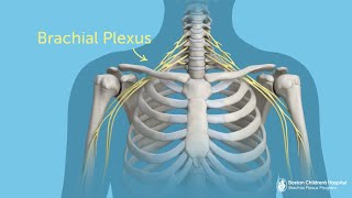 What Is Brachial Plexus Injury  Boston Children’s Hospital [upl. by Niki83]