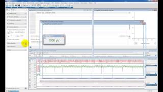 Analysing Pressurevolume PV loops using ADInstruments LabChart Pro [upl. by Merril]