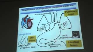 Dr Azza Helminths Nematodes 3 Ancylostoma Duodenale amp Trichostrongylus Colubriformis YouTub [upl. by Beau]