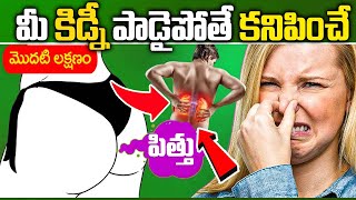 Kidney Disease Symptoms In Telugu  Dr VamshiPriya  iD Health 360 [upl. by Kayne]