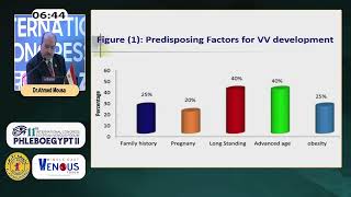 Different Management Options for Primary Varicose Veins in Females A Prospective Study [upl. by Torey]