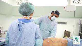 Vaser Liposuction Ameliyatı İzle  Flora Klinik [upl. by Balch793]