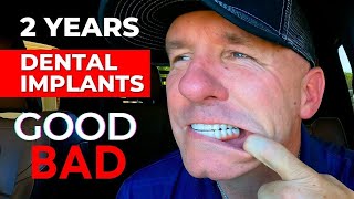 The GOOD and BAD Of My Dental Implants After 2 Years [upl. by Pelagias]