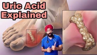 Uric Acid Problem Explained  Natural Cure amp Diet  DrEducation Hindi [upl. by Ahsanat259]