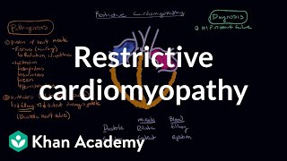 Restrictive cardiomyopathy Pathophysiology and diagnosis  NCLEXRN  Khan Academy [upl. by Idmann]