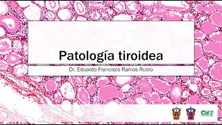 Patología tiroidea y prostática [upl. by Jenni]