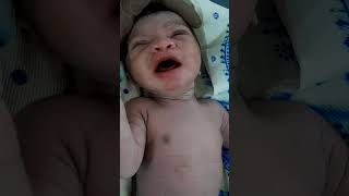 Postterm baby after birthcute baby shorts shortsvideo viralshorts [upl. by Piefer]