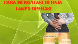 Tips cara mengatasi hernia tanpa operasi [upl. by Ardene515]