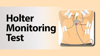 Holter Monitoring Test [upl. by Kopans]