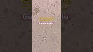 Giardia lamblia under the microscope laboratory microscope mls cls medtechstudent [upl. by Fulvia]