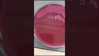 Klebsiella pneumonia grow in macConkey agar for blood cs  Microbiologist  bacterilogh microb mp [upl. by Merla579]