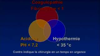 Prise en charge en urgence des pertes de substances osseuses des membres [upl. by Raymund747]