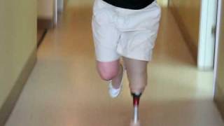 Left BKA Below Knee Amputee runningSpears Prosthetics [upl. by Auburn]