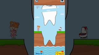 Slice this teeth🦷 to save trending viralvideo funny shorts [upl. by Vacuva]