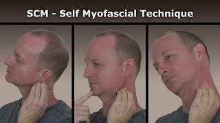 SCM Self Myofascial Release Technique [upl. by Aseeral74]