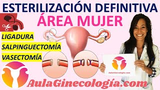 EFECTOS Y CONSECUENCIAS DE LA LIGADURA DE TROMPAS O POMEROY por GINECOLOGA DIANA ALVAREZ [upl. by Eustacia]